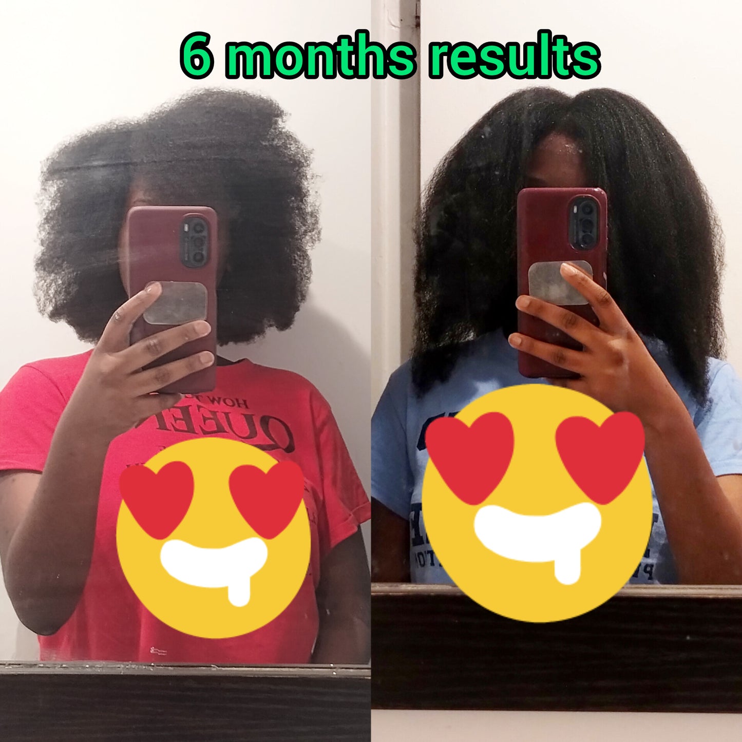 Extreme Hair Growth Kit