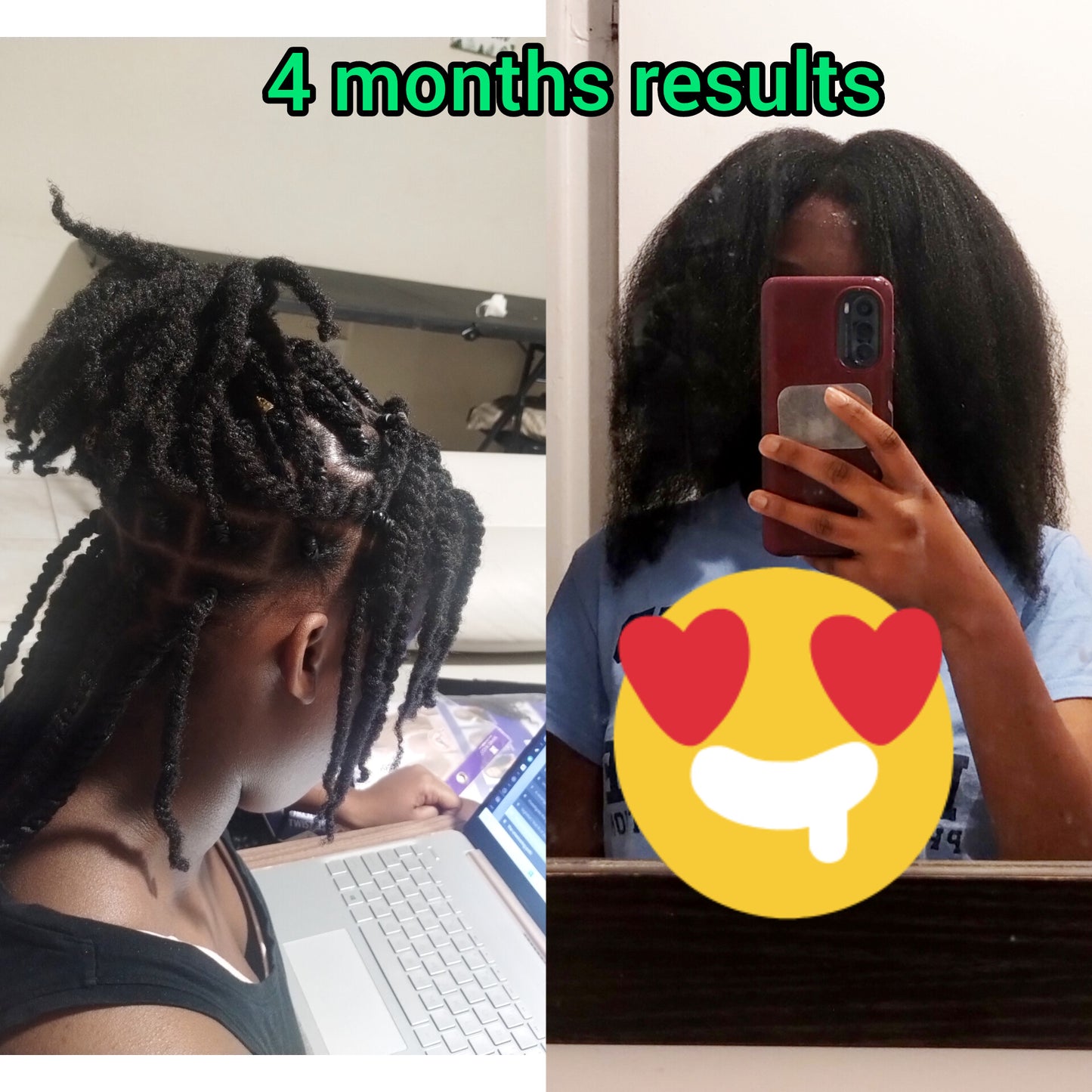 Extreme Hair Growth Kit