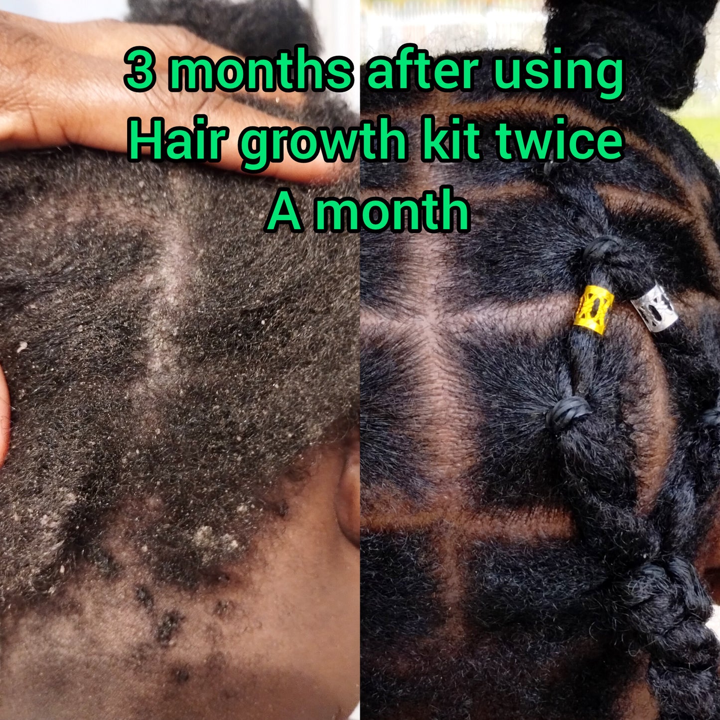 Extreme Hair Growth Kit