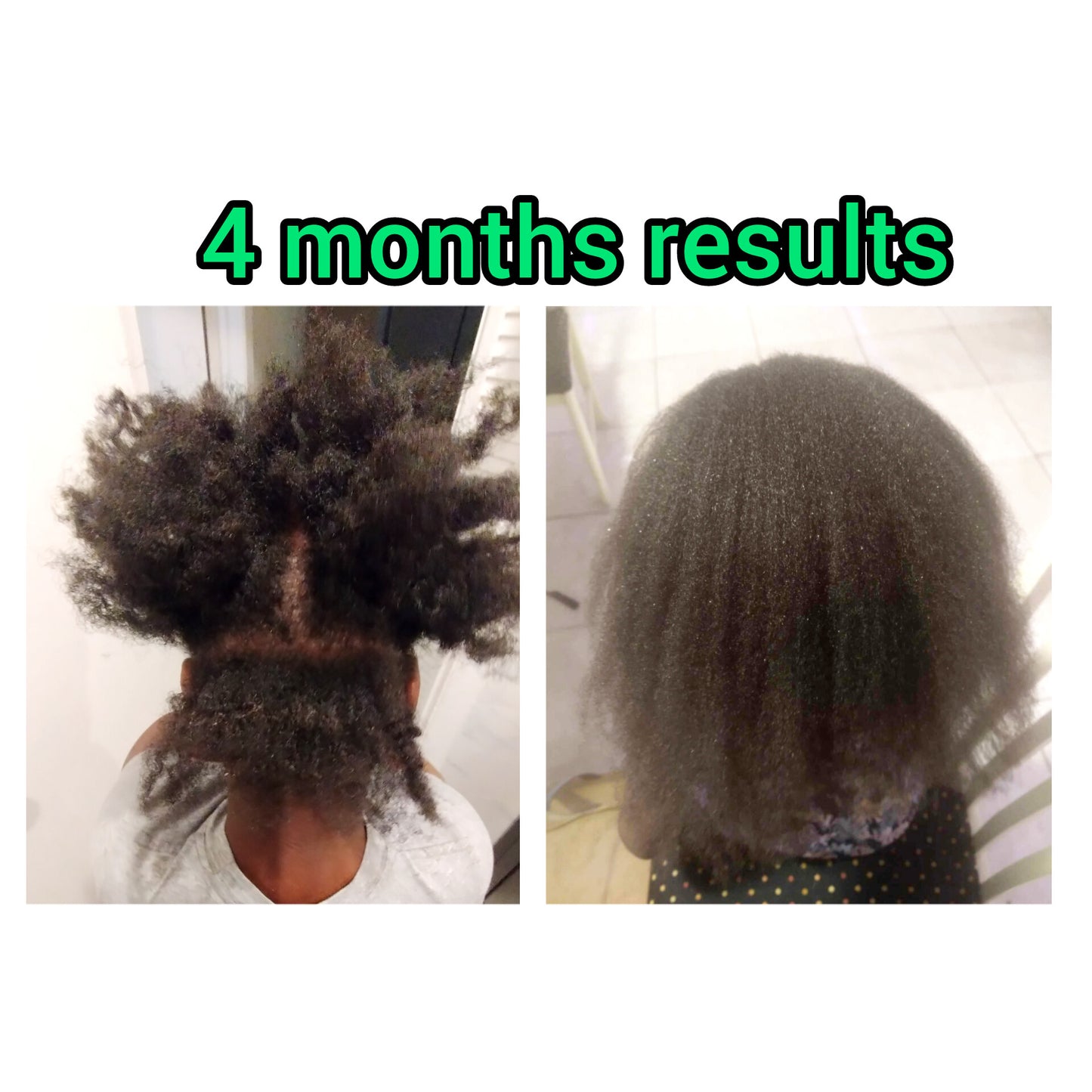 Extreme Hair Growth Kit