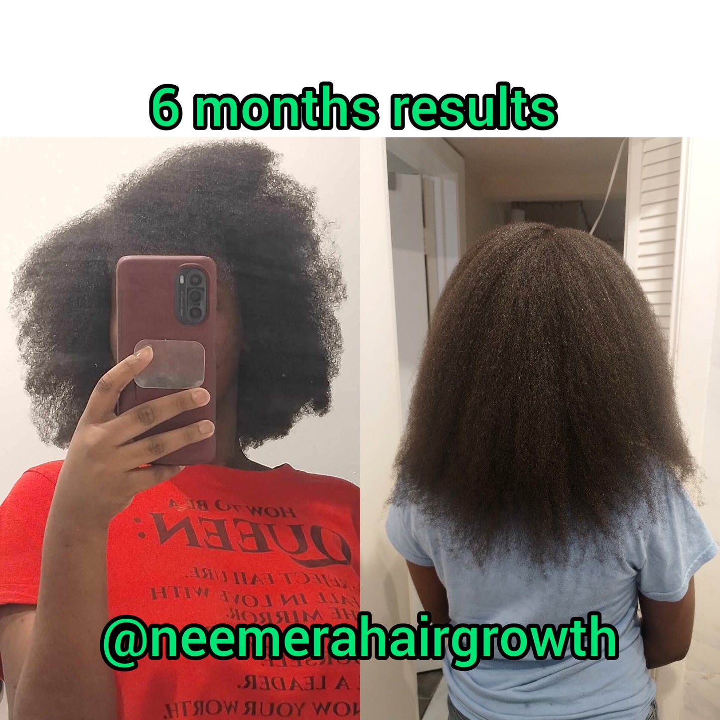 Extreme Hair Growth Kit