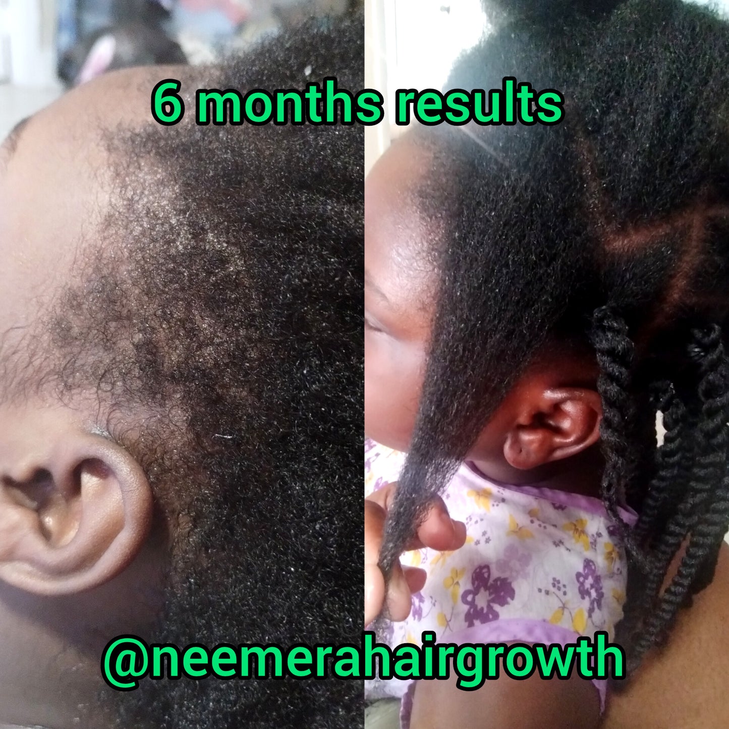 Extreme Hair Growth Kit