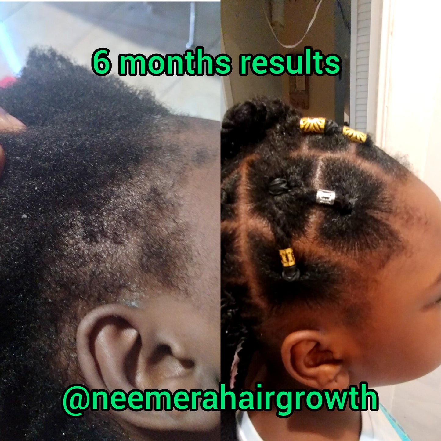 Extreme Hair Growth Kit